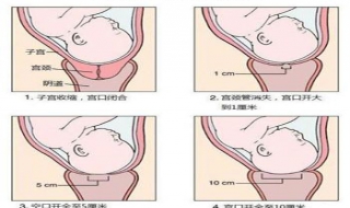 分娩的第一产程是什么？准妈妈要提前了解