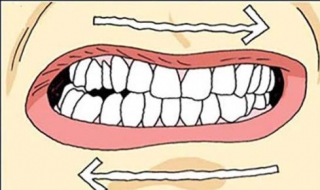 磨牙怎么办 具体内容具体分析