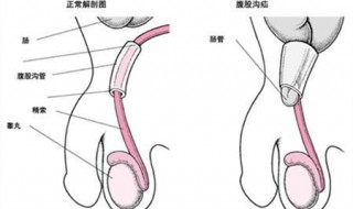 氙气的症状是什么 主要有这几点