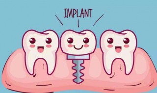 为何不建议做种植牙 良心医生不建议种植牙的缘由