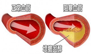 胆固醇高的原因和危害 下面有详细介绍