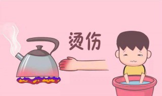 烫伤如何处理 用什么办法解决