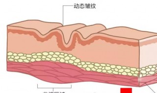 法令纹怎么去除最有效 如何简单有效的消除法令纹