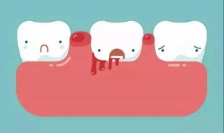 一刷牙就出血怎么办 一刷牙就出血的解决方法