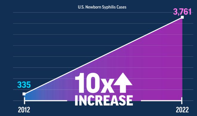 美疾控中心：美国新生儿梅毒病例10年激增10倍