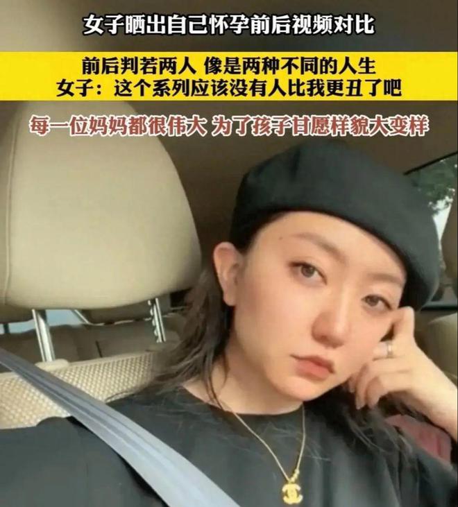 感慨！女子晒自己怀孕前后对比，从美人到大鼻子，简直判若两人